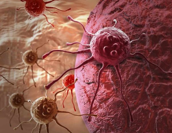 En el país, hay más de 100 mil nuevos casos de cáncer por año